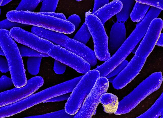 E. coli gehienetan emakumezkoetan zistitisaren garapena eragiten du